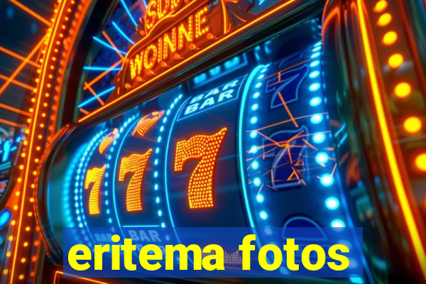 eritema fotos